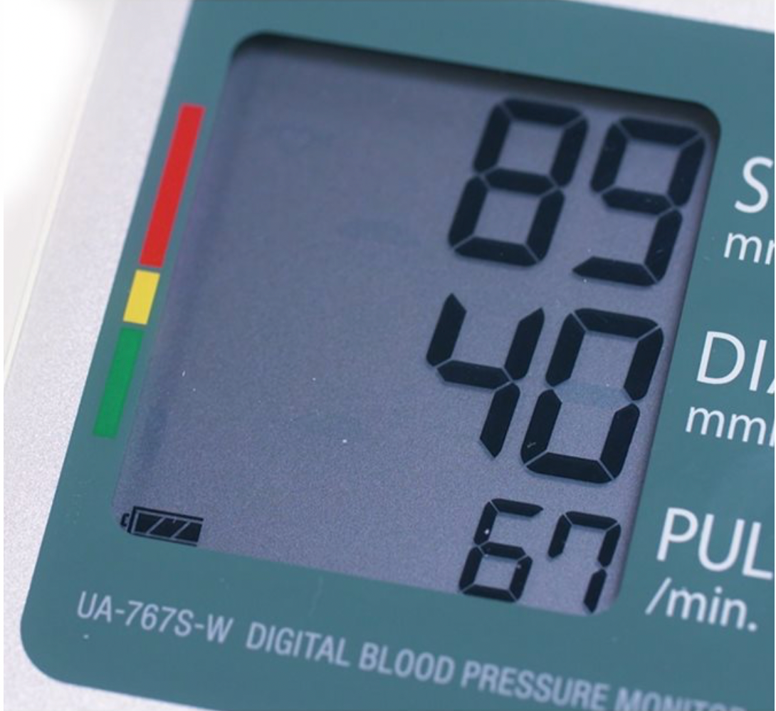 A&D UA - 767S Automatic Blood Pressure Monitor